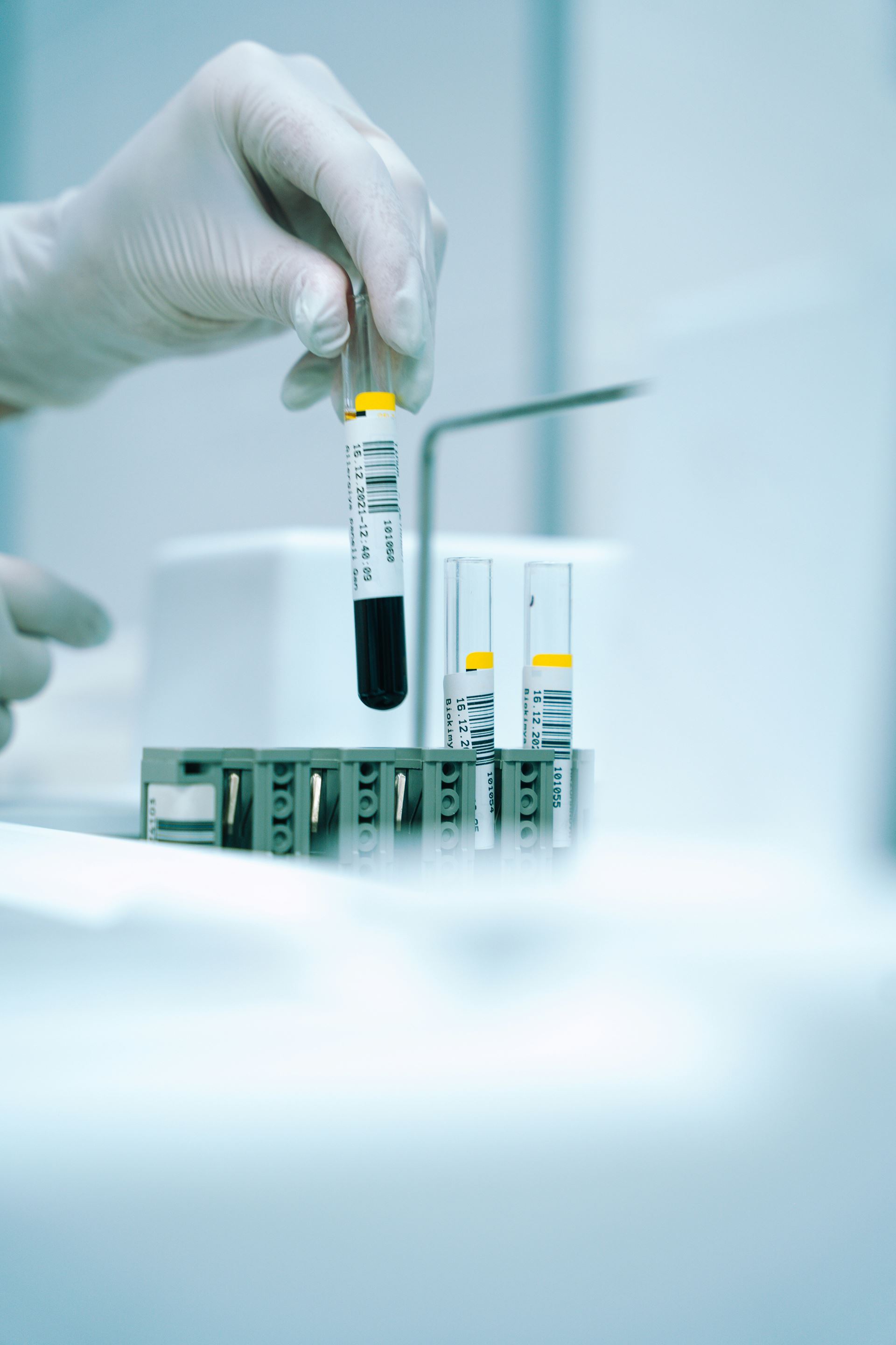 blood test